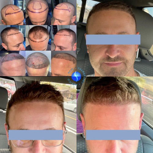 before  and  After 
