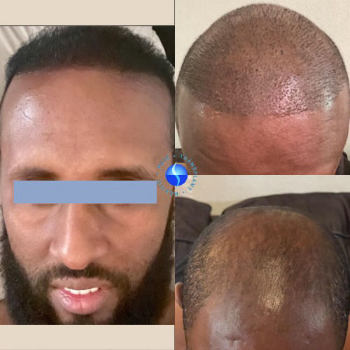 before  and  After 