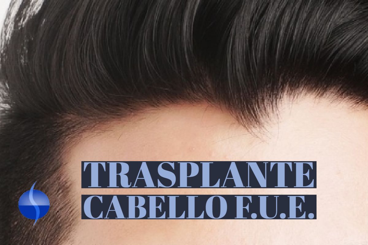 Trasplante cabello F.U.E.