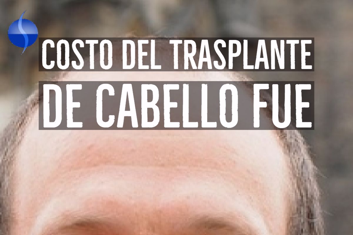 Costo del trasplante de cabello en mexico