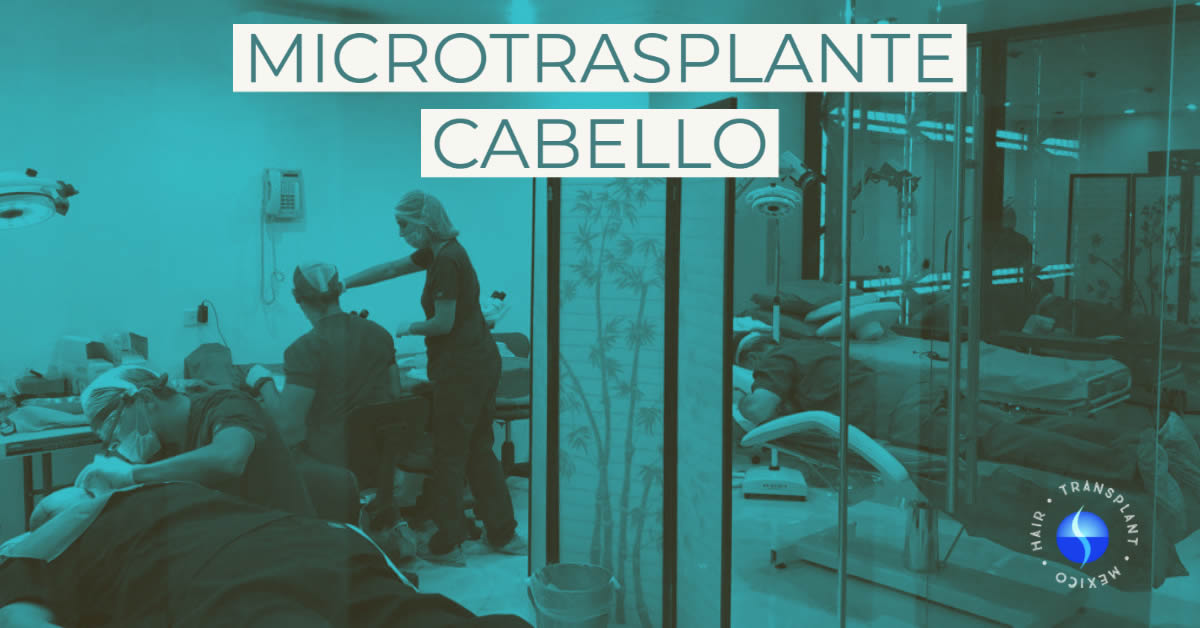 Acerca de microtrasplante de cabello mexico